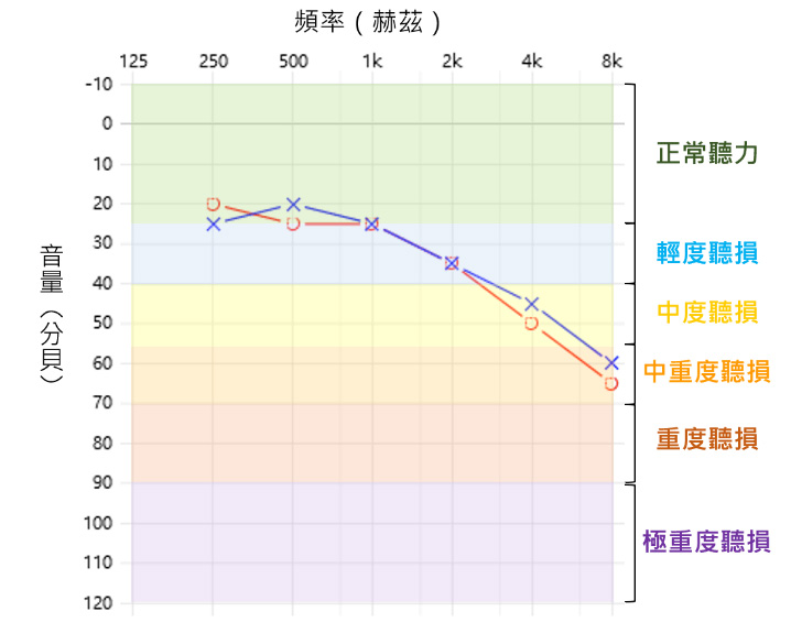 純音聽力報告圖